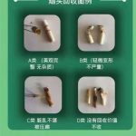 回收烟头项目是骗局吗?周周进财告诉您!